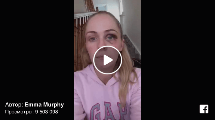 Молодая мама двоих детей рассказала, как ее избивает муж, чтобы привлечь внимание к проблеме насилия