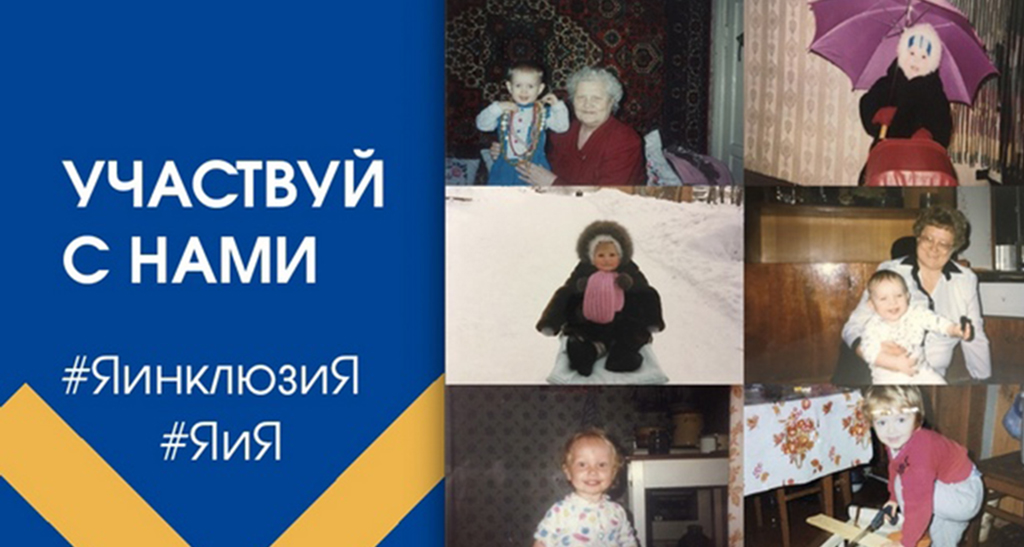 Свои детские снимки с хештегом #ЯинклюзиЯ выложили в сеть артисты, блогеры, политик. Фото: соцсети.