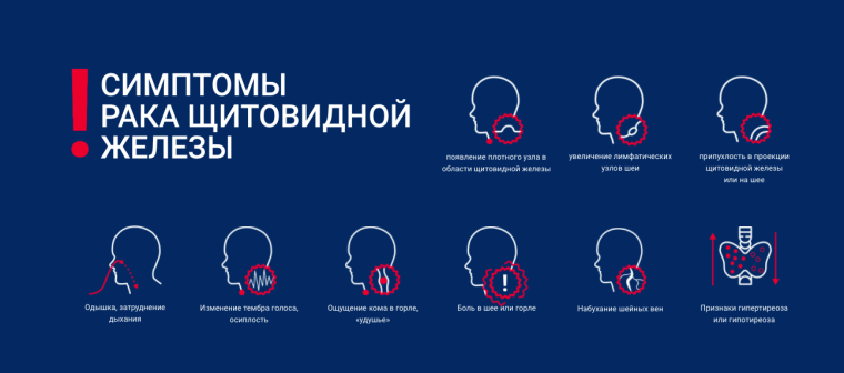 Симптомы рака щитовидной железы. Инфографика «Онконавигатора».
